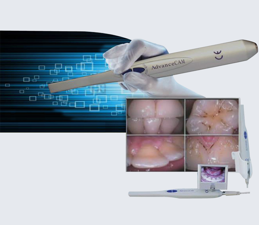 camara intraoral dental peru